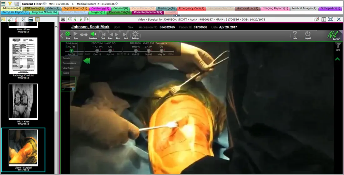 NilRead Enterprise Viewer von Hyland – medizinische Bildansicht im Browser